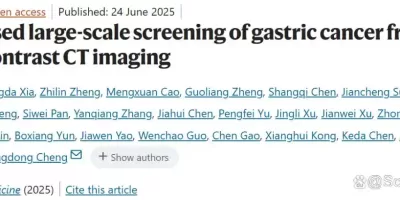 平扫CT+AI实现大规模胃癌早筛，浙肿、达摩院团队开发GRAPE